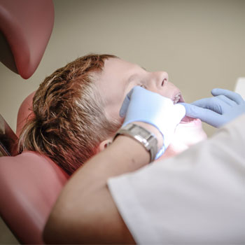 extração de dente siso